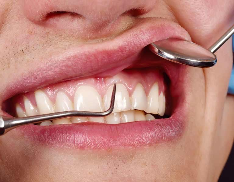 Dentist examining a patient’s gums at a dental clinic in Stafford, VA