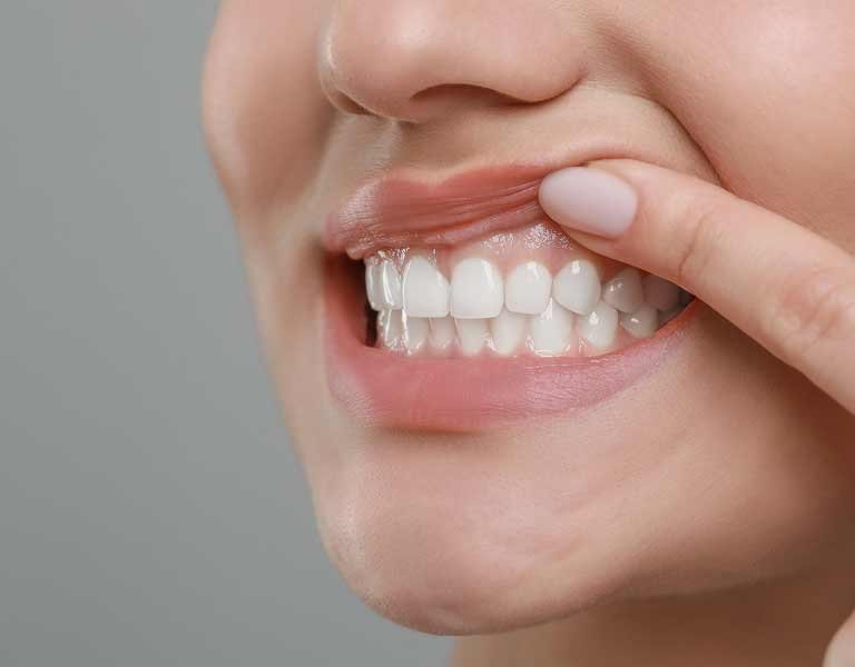 Woman showing her healthy gums at a dental clinic in Stafford, VA