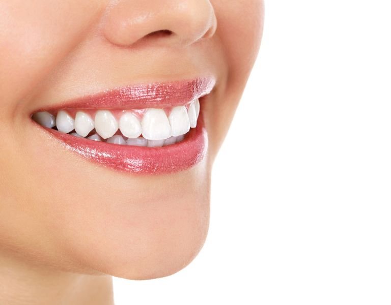 Digital Smile Design in Stafford, VA - What is digital smile design