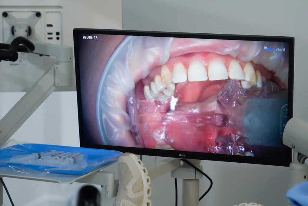 Dental Technology Devices Image - 4 at Karande Biological Dentistry