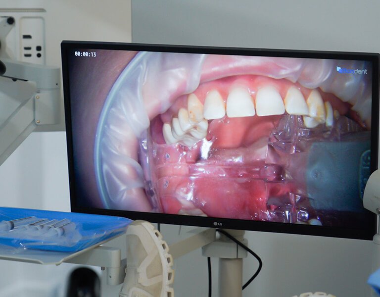 Digital Imaging Treatments at Karande Biological Dentistry