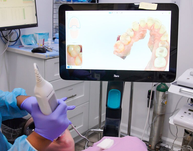 Digital Scanner Device at Karande Biological Dentistry